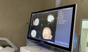 УжНУ отримав сучасну медичну систему нейронавігації у рамках ґранту HUSKROUA